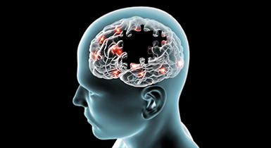 Alzheimer