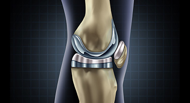 knee joint replacement devices