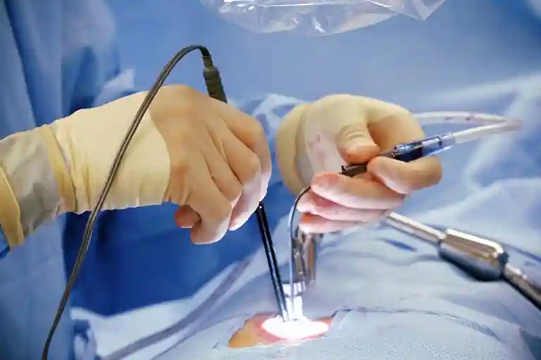 All you need to know about Minimal Invasive Cardiac Surgery