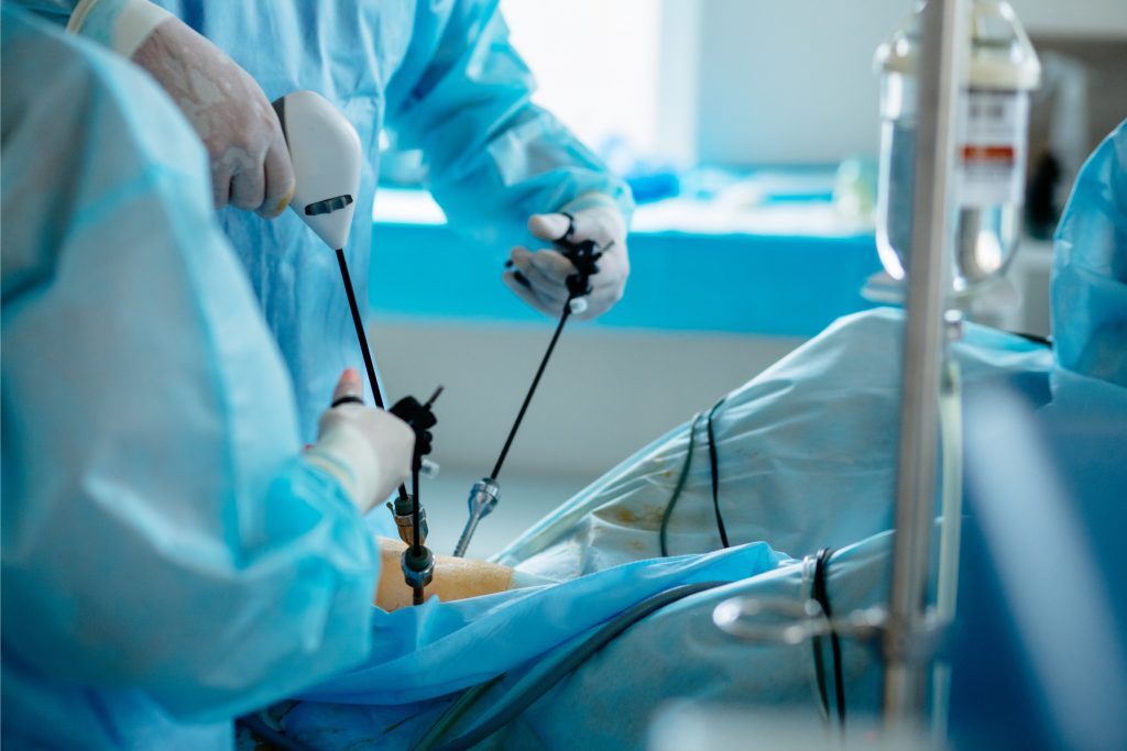Minimal Invasive Cardiac surgery