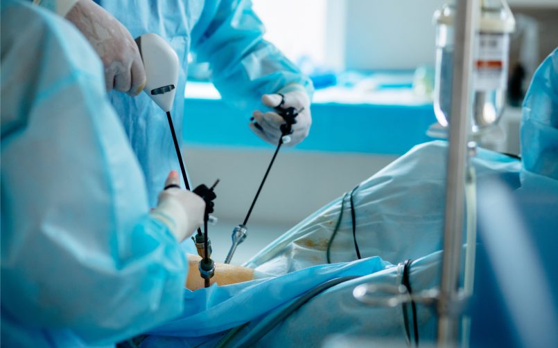 Minimal Invasive Cardiac surgery