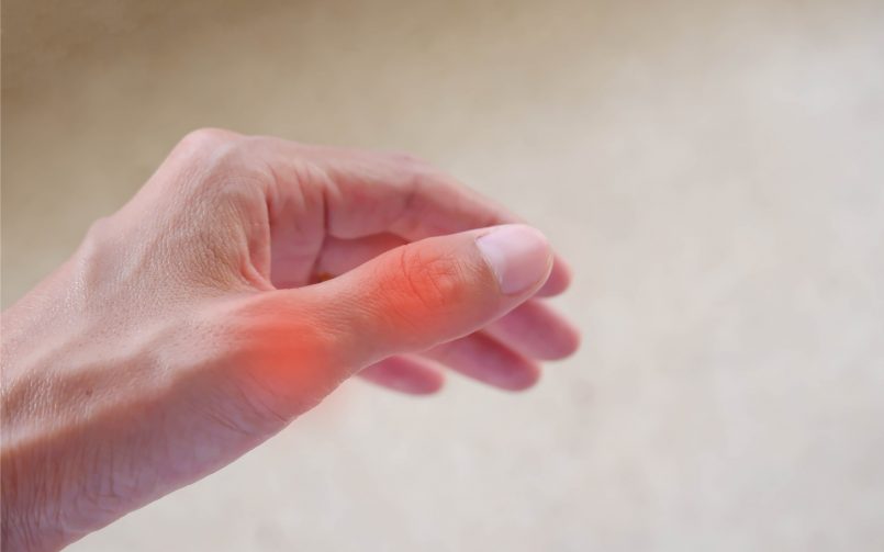 rheumatoid arthritis