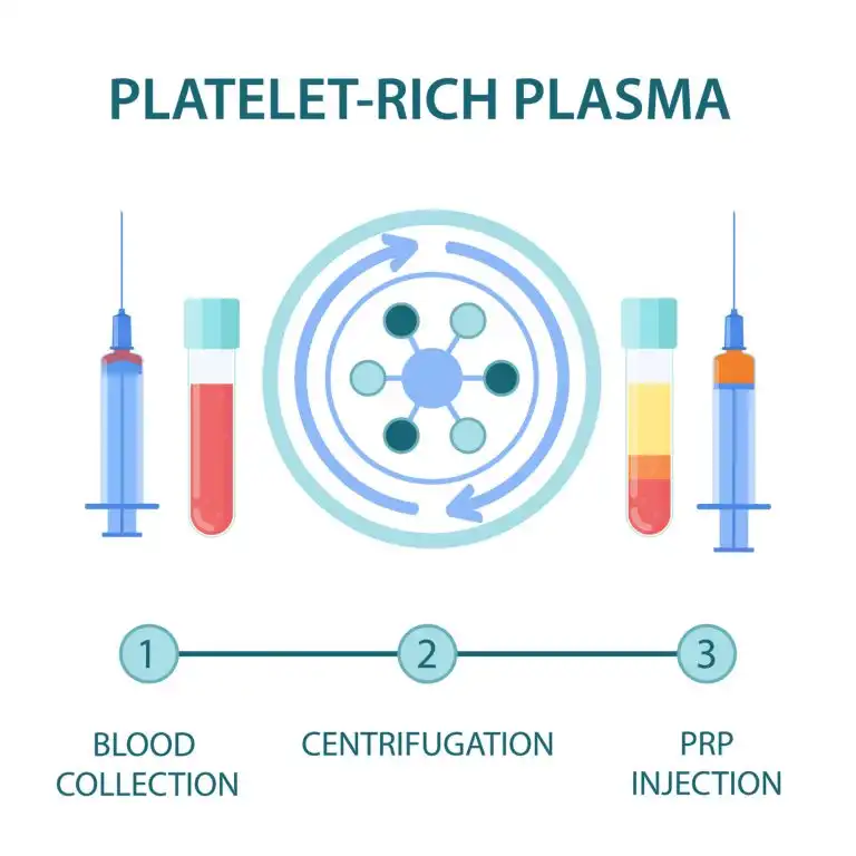 Plasma Therapy