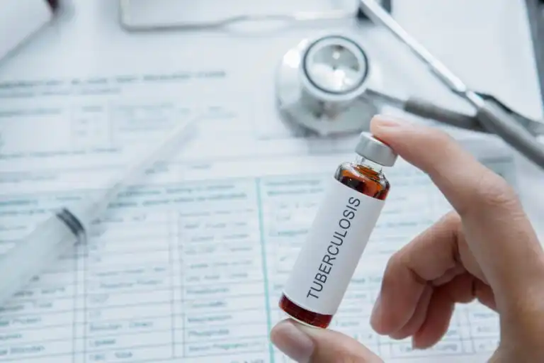 Tuberculosis