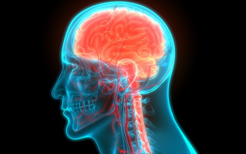 Symptoms of a Stroke