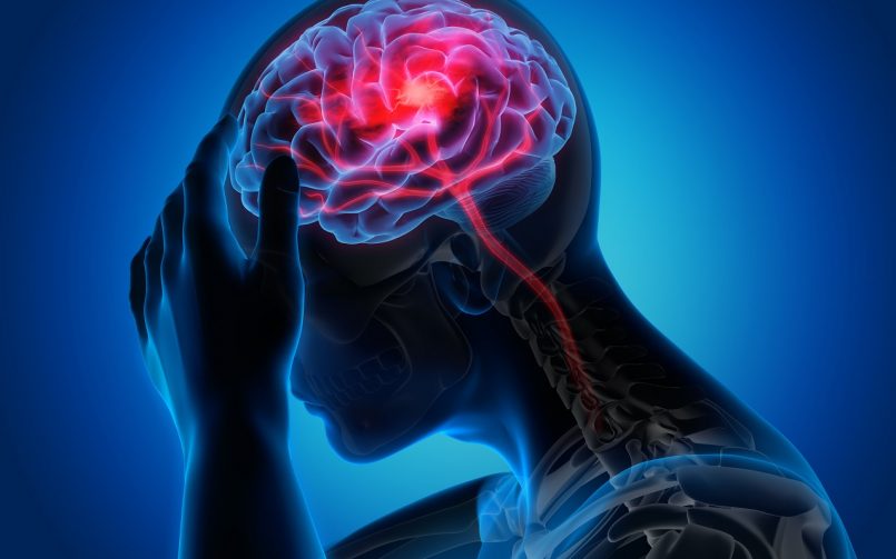 Brain-Stroke