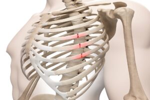 Ribs Fractured