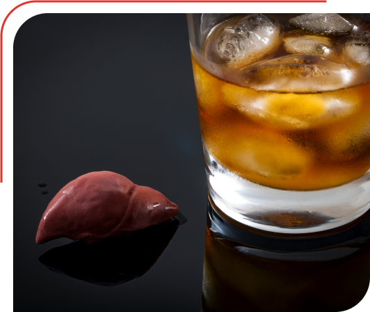 Liver Transplant