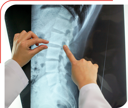 Radiology Treatment