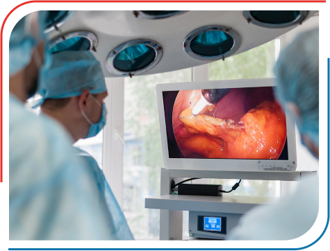 Laparoscopic Surgery