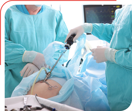 Laparoscopic Treatment