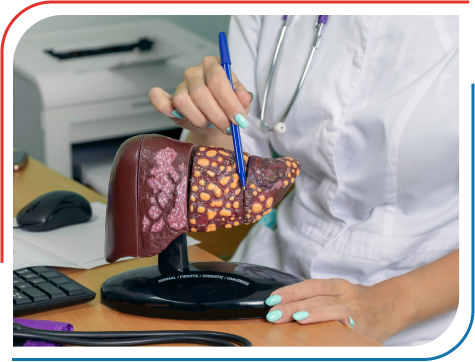 Liver Transplant Surgery