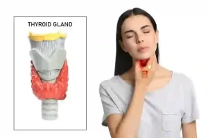 Thyroid Nodules