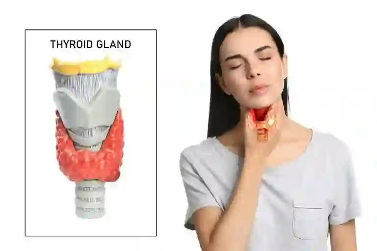 Thyroid Nodules